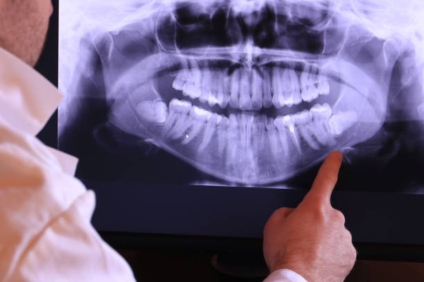 Best Emergency Dental Extractions in Oak Hill, OH