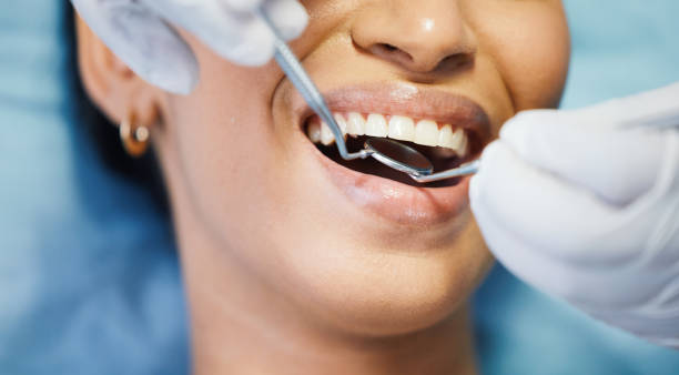 Best Emergency Dental Care for Abscessed Tooth in Oak Hill, OH